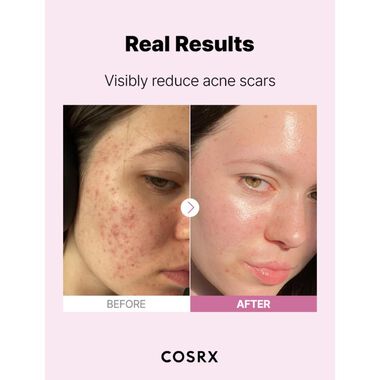 The Niacinamide 15 faces the niacinamide 15