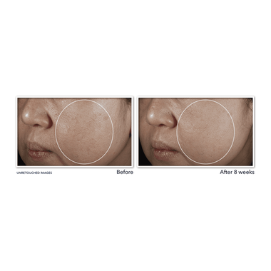 Multi Correxion Even Tone And Lift Night Cream faces multi correxion even tone and lift night cream