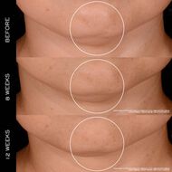 faces r nergie 300 peptide