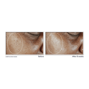Multi Correxion Even Tone And Lift Daily Moisturizer Spf34 faces multi correxion even tone and lift daily moisturizer spf34