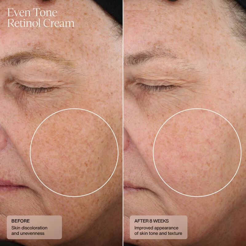sente even tone retinol cream