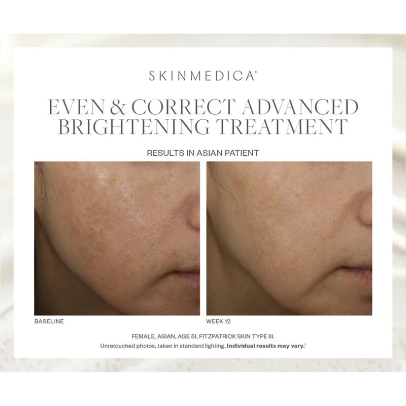 skinmedica even and correct advanced brightening serum