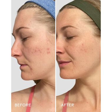 faces refresh papaya plus salicylic acid cleanser