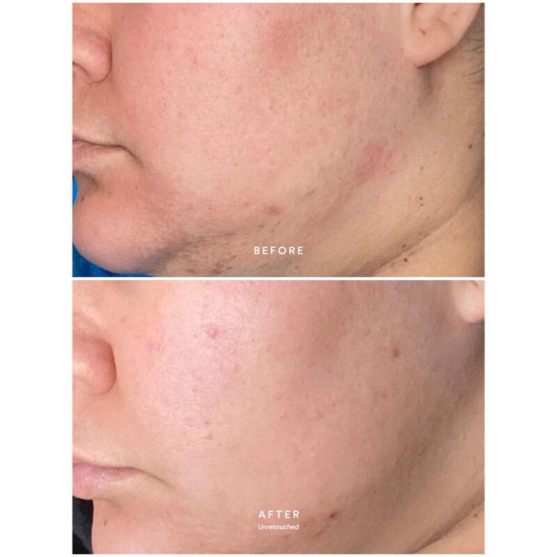 ترو بوتانيكلز زيت كالم بيور راديينس