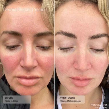 faces dermal repair cream