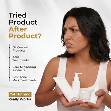 Acne Toner faces acne toner