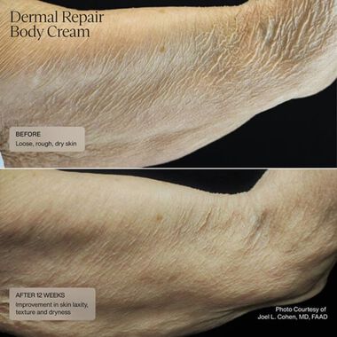 faces dermal repair body cream