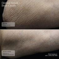 Dermal Repair Body Cream faces dermal repair body cream