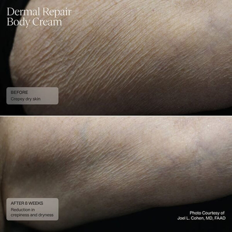 sente dermal repair body cream