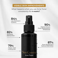 faces acne toner