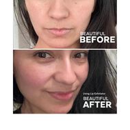 Hydrating Lip Treatment Kit faces hydrating lip treatment kit