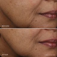 faces bakuchiol retinol alternative serum