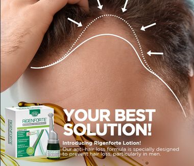 faces intensive anti hair loss treatment lotion