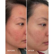 faces سيروم إصلاح حاجز البشرة بالسيراميدات والتوت الأزرق 30 مل
