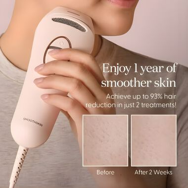 faces ipl pure switch